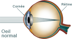 oeil normal2