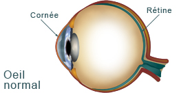 oeil normal